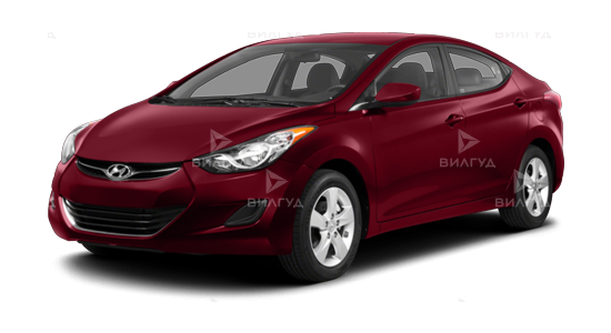 Ремонт дроссельного узла Hyundai Avante в Саратове